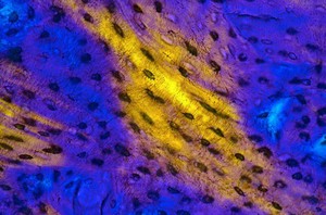 view Bone showing osteocyte lacunae