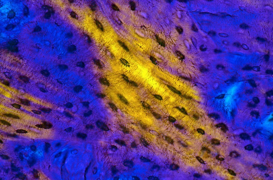 Bone showing osteocyte lacunae