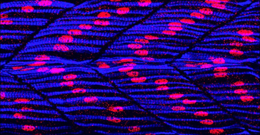 Slow muscle fibres in zebrafish myotomes