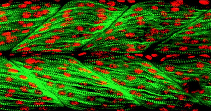 Fast muscle fibres in zebrafish myotomes