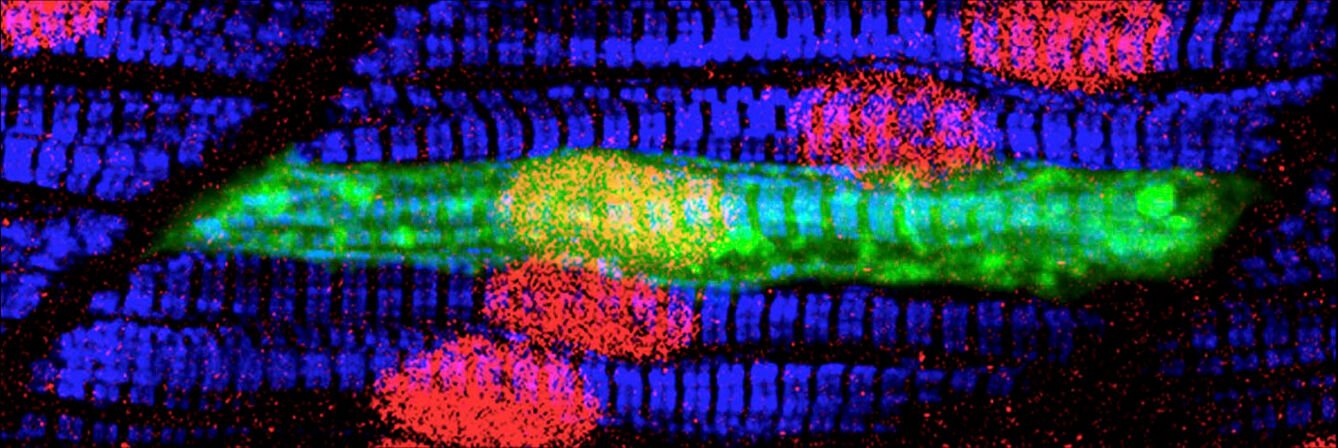 Fast and slow muscle fibres in zebrafish myotomes