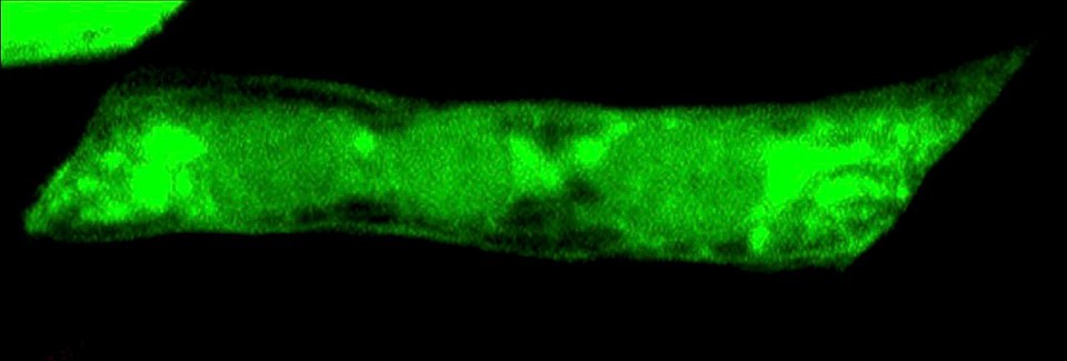 Single muscle cell