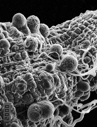 Malaria parasites in a mosquito midgut