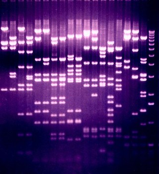 Separation of DNA fragments by electrophoresis through an agarose gel. An electric current is passed through the gel and separates the DNA fragments according to size. The mixture of fragments is applied to a well at the top of the gel before the current is started. The smaller fragments travel further and reach the bottom of the gel while the larger ones remain towards the origin.