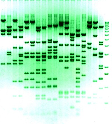 Separation of DNA fragments by electrophoresis through an agarose gel.