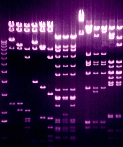 Separation of DNA fragments by electrophoresis through an agarose gel. An electric current is passed through the gel and separates the DNA fragments according to size. The mixture of fragments is applied to a well at the top of the gel before the current is started. The smaller fragments travel further and reach the bottom of the gel while the larger ones remain towards the origin.