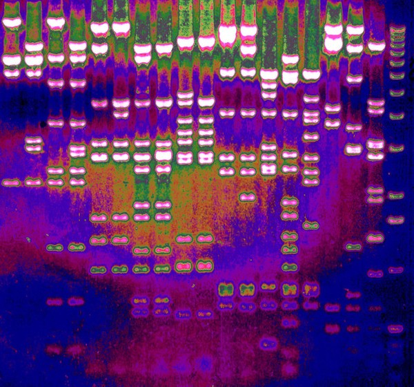 Separation of DNA fragments by electrophoresis through an agarose gel.