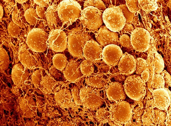 Adipose tissue, close-up showing adipocytes, SEM