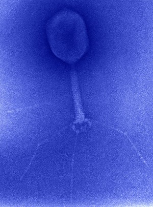 view Bacteriophage, TEM