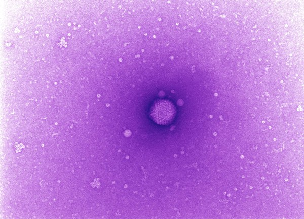 Adenovirus, TEM