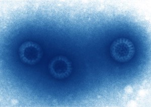 view Bovine rotavirus, TEM