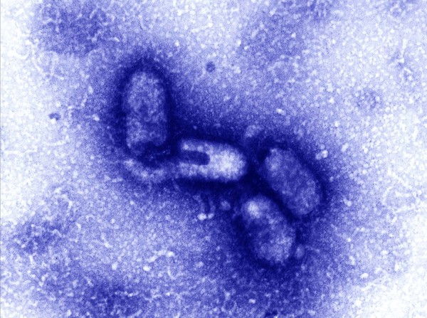 TEM of a rhabdovirus