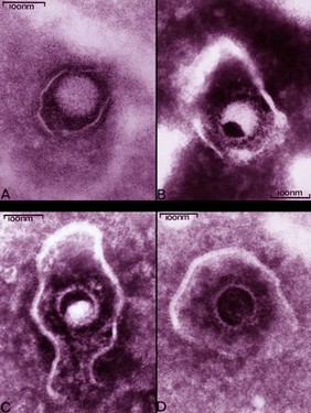 Herpes simplex virus, 4 views, TEM