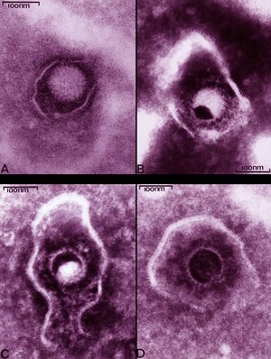 view Herpes simplex virus, 4 views, TEM