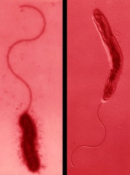 Campylobacter, SEM