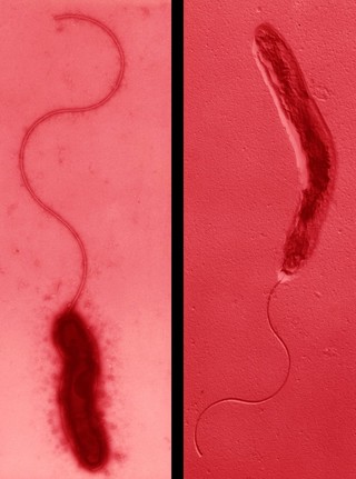 Campylobacter, SEM