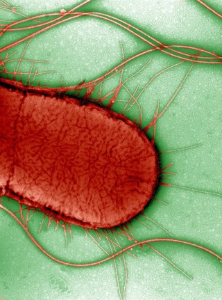 Electron micrograph of Escherichia coli, close-up