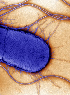 view Electron micrograph of Escherichia coli, close-up