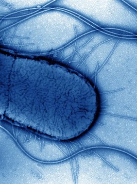 Electron micrograph of Escherichia coli close-up