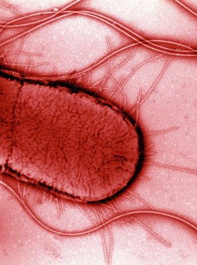 Electron micrograph of Escherichia coli, close-up