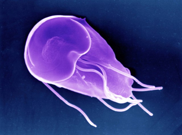 SEM of Giardia, ventral view