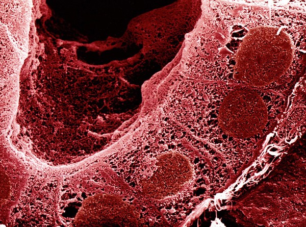 SEM section through kidney tubule, computer-coloured red.