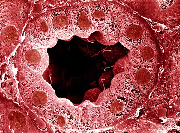 SEM section through kidney tubule