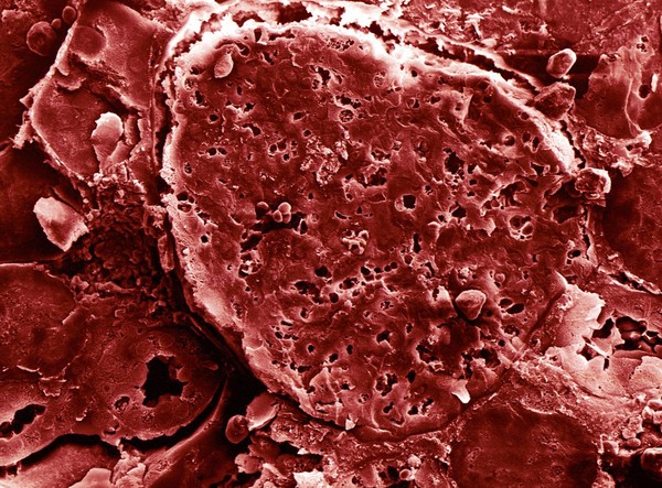 SEM section through kidney tubule, computer-coloured red.