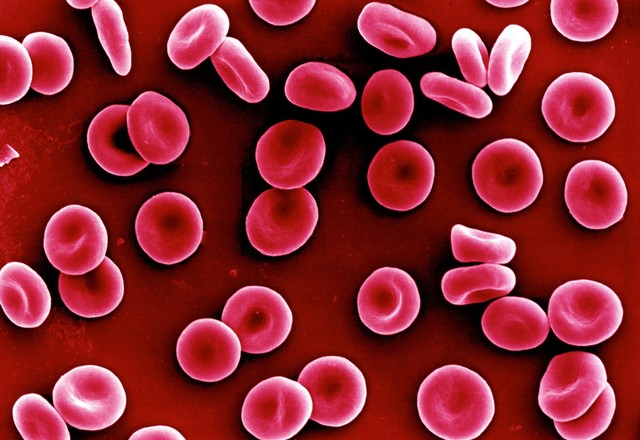 experiment-to-determine-the-enumeration-of-white-blood-corpuscles-w-b