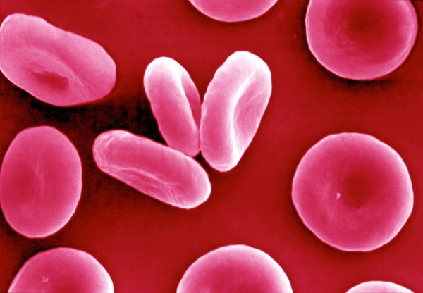 SEM of red blood corpuscles, close-up