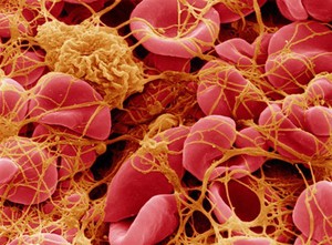 view SEM of blood corpuscles in clot.