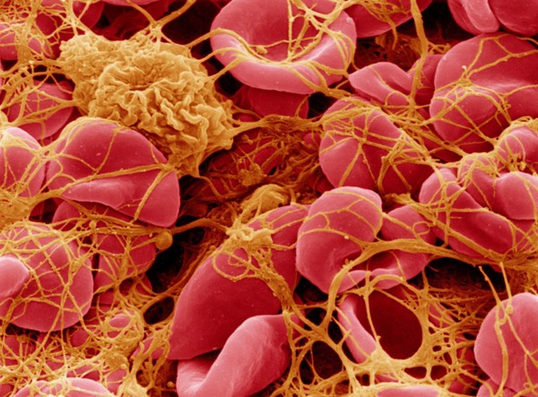 SEM of blood corpuscles in clot.