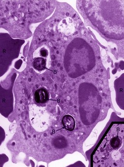 TEM of leukocytes (white blood cell)