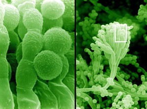 view SEM Penicillium mould & spores, close-up