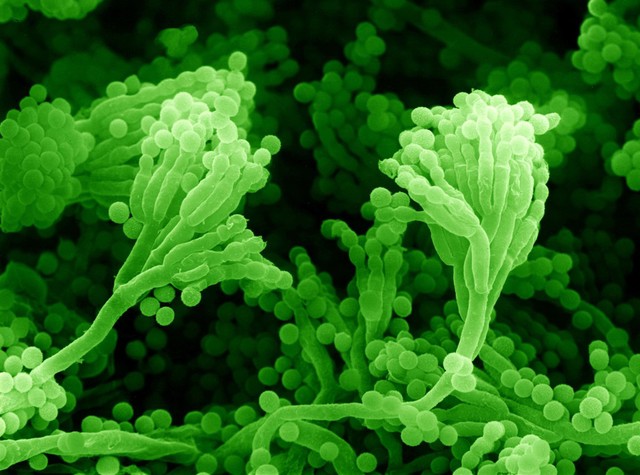 SEM Penicillium mould & spores, close-up