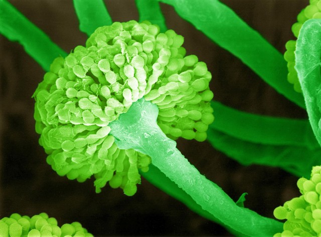SEM Aspergillus mould producing spores (conidia)