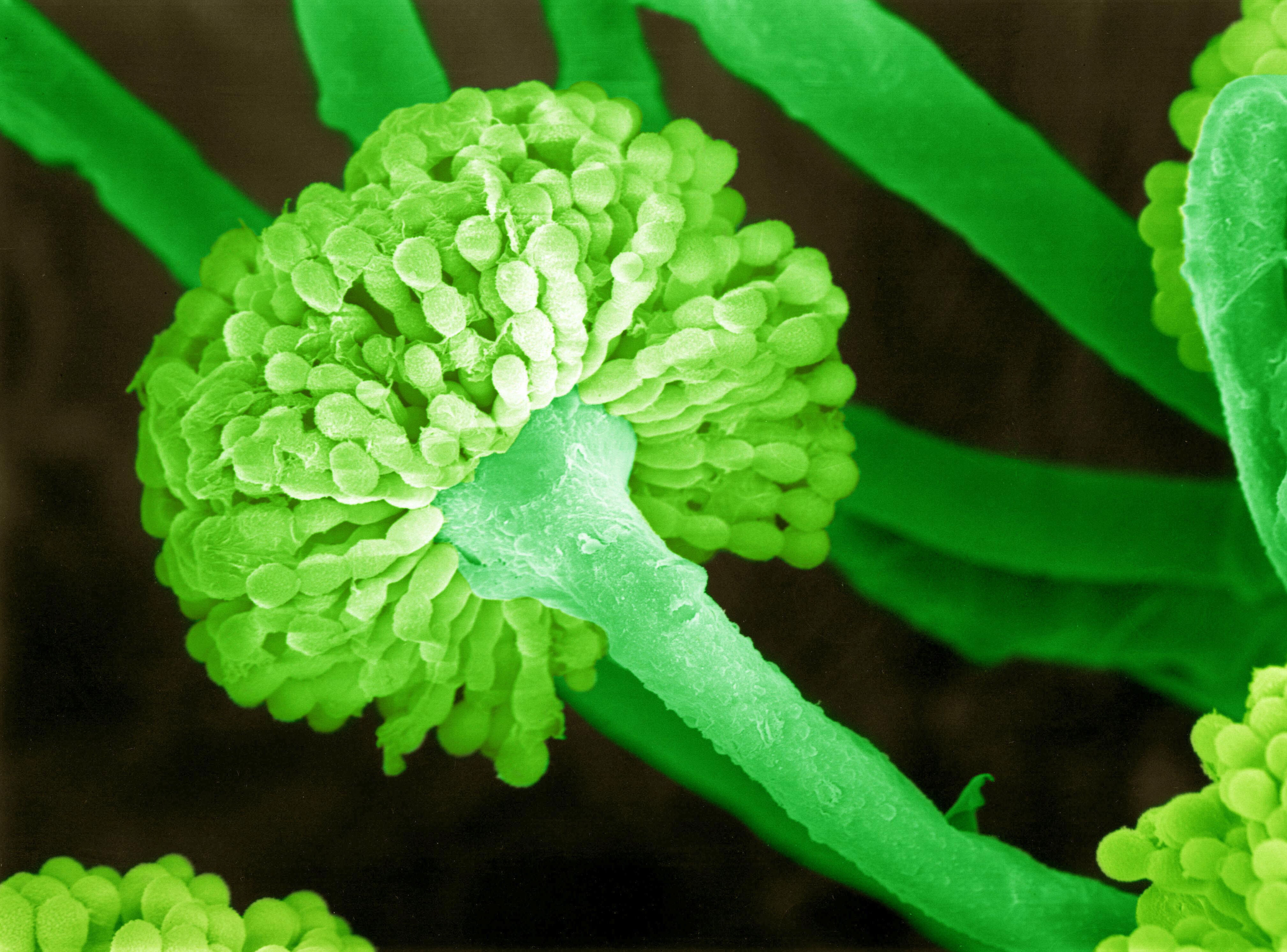 SEM Aspergillus mould producing spores (conidia) | Wellcome Collection