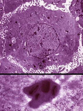 TEM mouse cell, with close-up of inclusion.