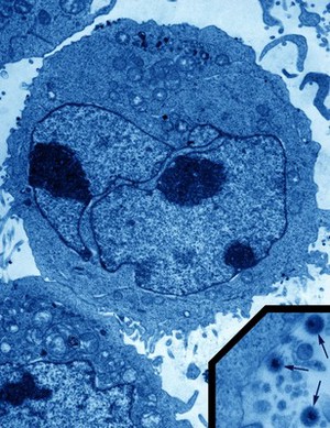 view TEM of a lymphoblast.