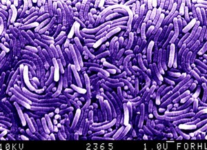 view SEM of colony of Helicobacter