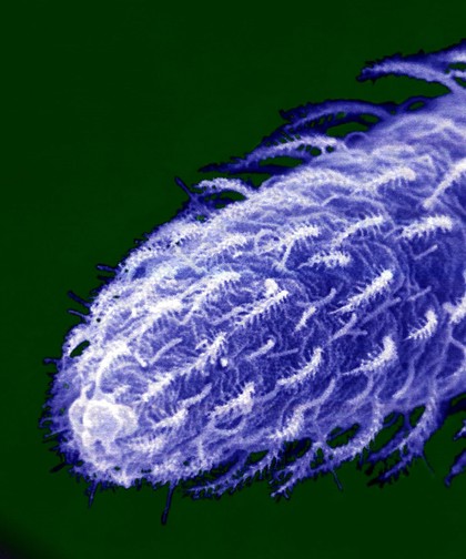 SEM close-up of tip of insect antenna