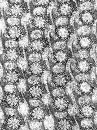 Basal bodies in cross section