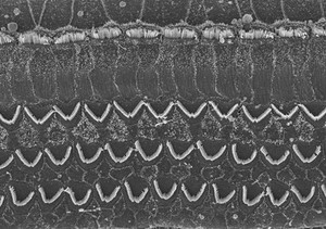 view Hair cells in the organ of Corti