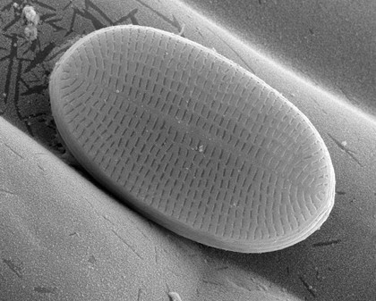 Diatom