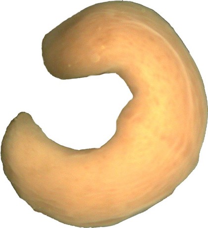 Xenoturbella, marine worm related to humans
