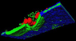 view Osteoclast resorption of bone