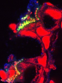 Pathogenic E. coli on the intestinal lining