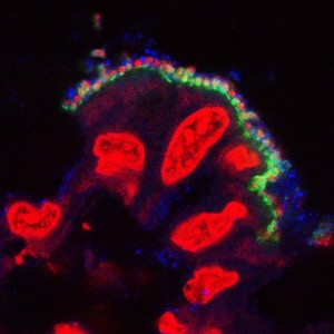 view Pathogenic E. coli on the intestinal lining