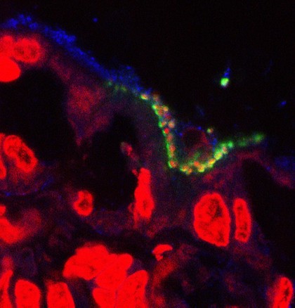 Pathogenic E. coli on the intestinal lining