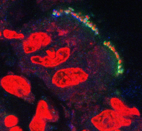 Pathogenic E. coli on the intestinal lining